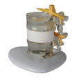 Vertebral Disc Prolapse Simulator