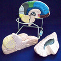 Brain,Enlarged