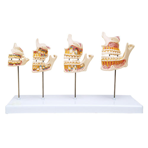 Development Of Teeth