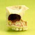 Teeth Eruption