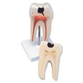Molar Tooth