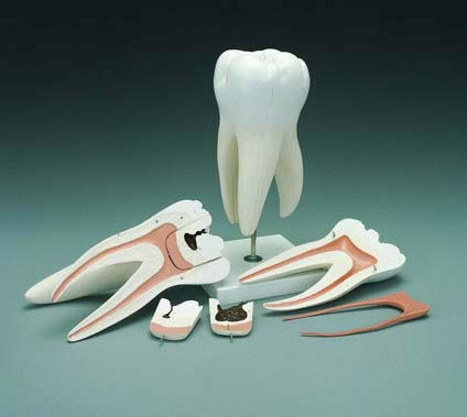 Tooth Decay Model