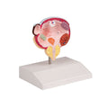 Diseases of the Urinary Bladder & Prostate