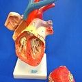 Heart Enlarged, Flexible Model, Numbered