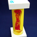 Occluded Artery Model