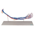 Vascular Arm
